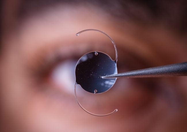 عوارض لنز داخل چشمی